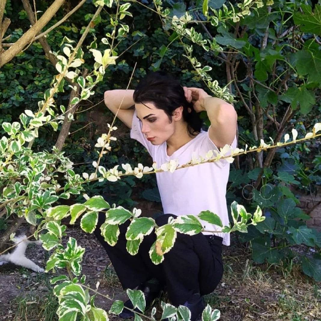 Michael Jackson'a benzemek için 40 bin dolar harcadı! Bakın neye benzedi... 41